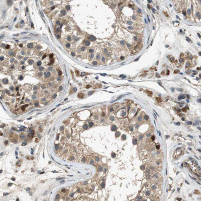 STCH Antibody in Immunohistochemistry (Paraffin) (IHC (P))