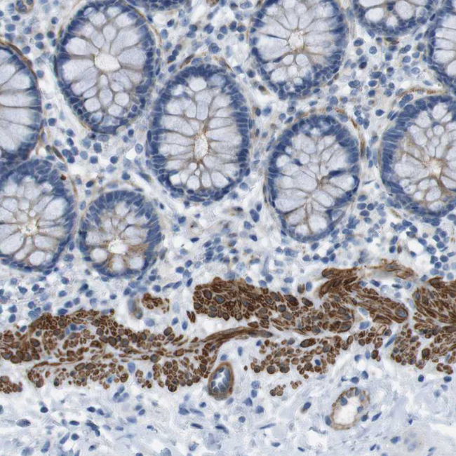 YIF1A Antibody in Immunohistochemistry (Paraffin) (IHC (P))