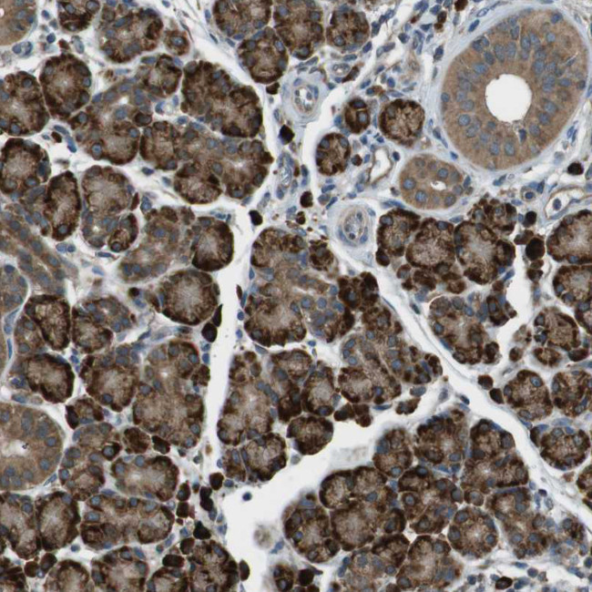 SSR3 Antibody in Immunohistochemistry (Paraffin) (IHC (P))