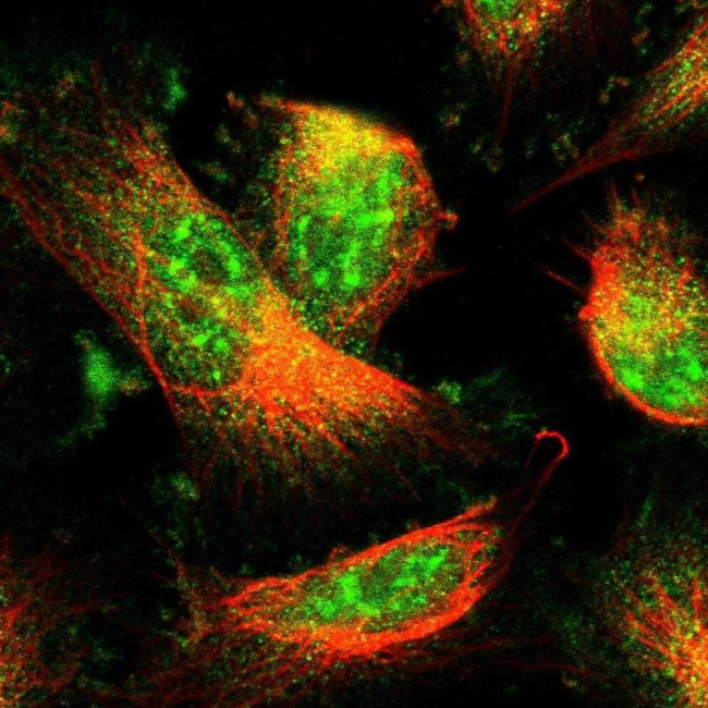 MAP17 Antibody in Immunocytochemistry (ICC/IF)