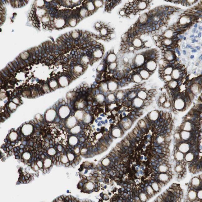 CDH8 Antibody in Immunohistochemistry (Paraffin) (IHC (P))