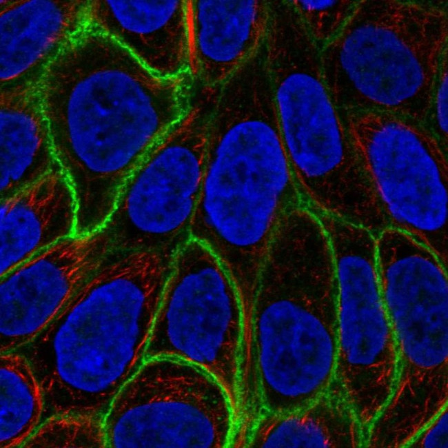 Aquaporin 3 Antibody in Immunocytochemistry (ICC/IF)