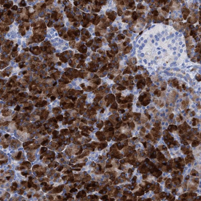 LPPR1 Antibody in Immunohistochemistry (Paraffin) (IHC (P))