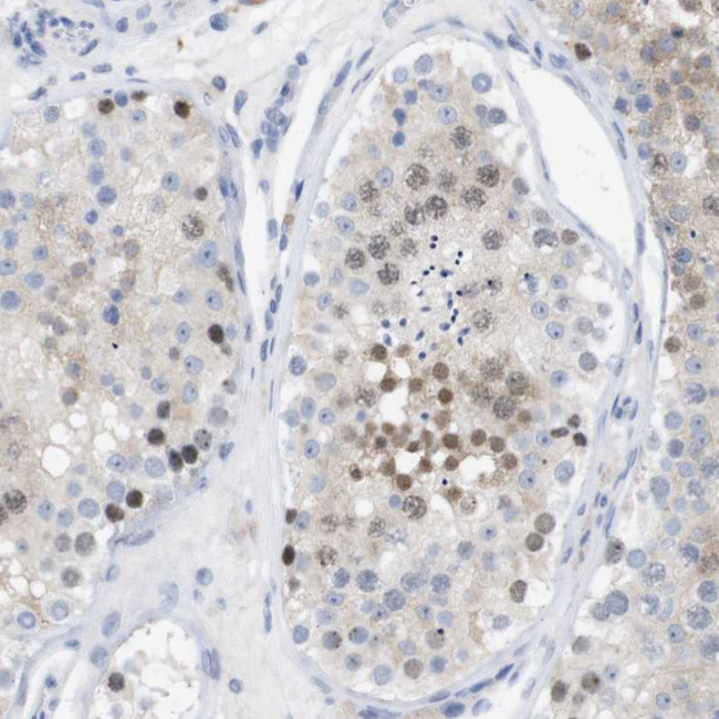 PNMA1 Antibody in Immunohistochemistry (Paraffin) (IHC (P))