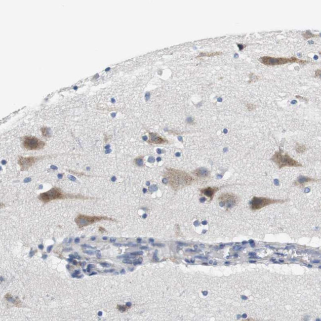 CNGA2 Antibody in Immunohistochemistry (Paraffin) (IHC (P))