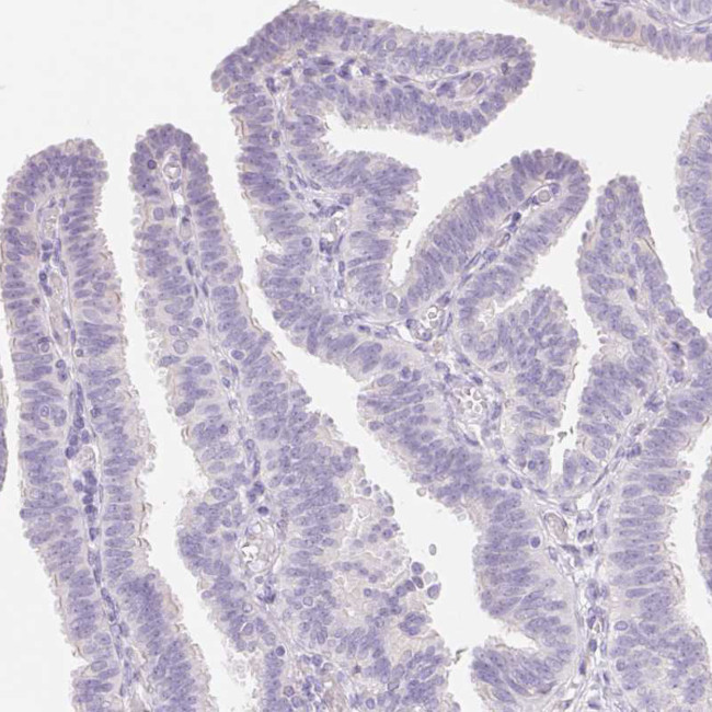Catenin delta-2 Antibody in Immunohistochemistry (Paraffin) (IHC (P))
