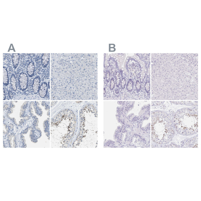 EQTN Antibody in Immunohistochemistry (IHC)