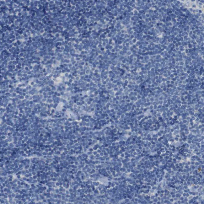 B4GALNT1 Antibody in Immunohistochemistry (Paraffin) (IHC (P))