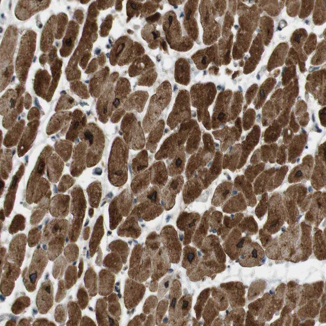SLC41A1 Antibody in Immunohistochemistry (Paraffin) (IHC (P))