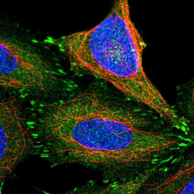 TES Antibody in Immunocytochemistry (ICC/IF)