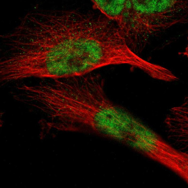 ZBTB11 Antibody in Immunocytochemistry (ICC/IF)