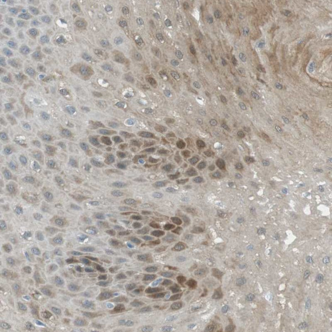 SERPINB2 Antibody in Immunohistochemistry (Paraffin) (IHC (P))