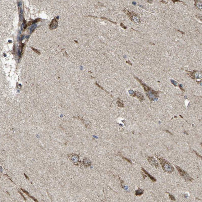 B3GNT1 Antibody in Immunohistochemistry (Paraffin) (IHC (P))