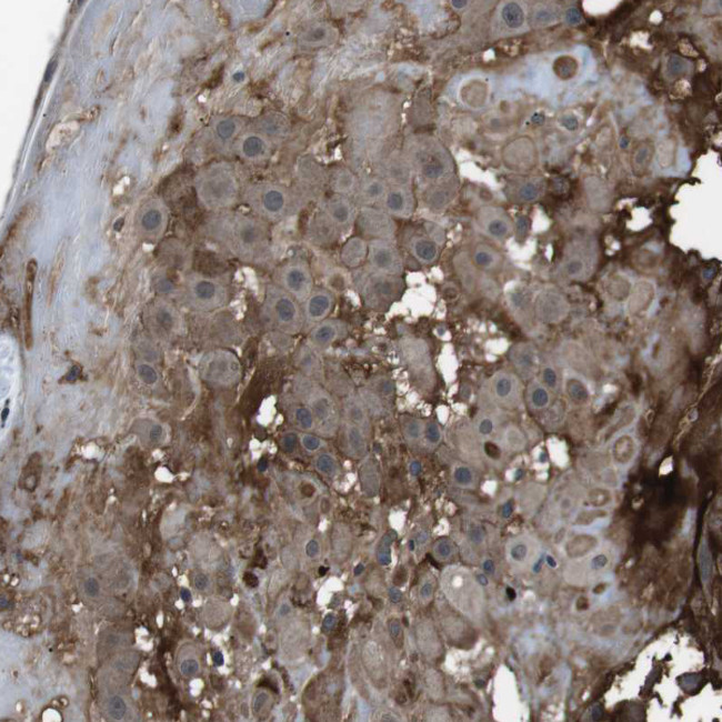 CDH20 Antibody in Immunohistochemistry (Paraffin) (IHC (P))