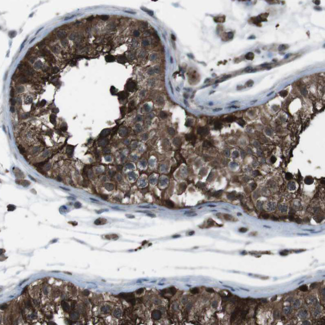 GDF10 Antibody in Immunohistochemistry (Paraffin) (IHC (P))