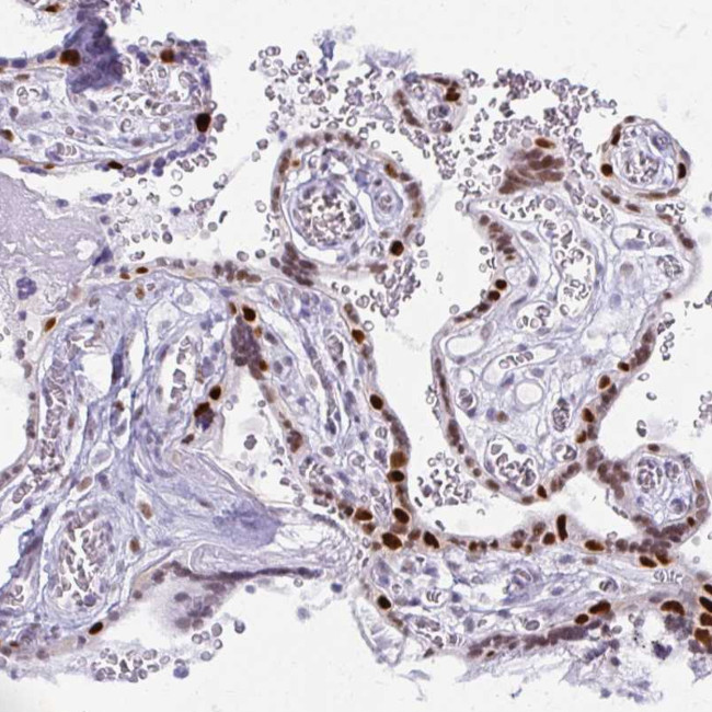 MORC4 Antibody in Immunohistochemistry (Paraffin) (IHC (P))