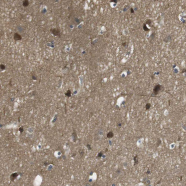 LRP15 Antibody in Immunohistochemistry (Paraffin) (IHC (P))