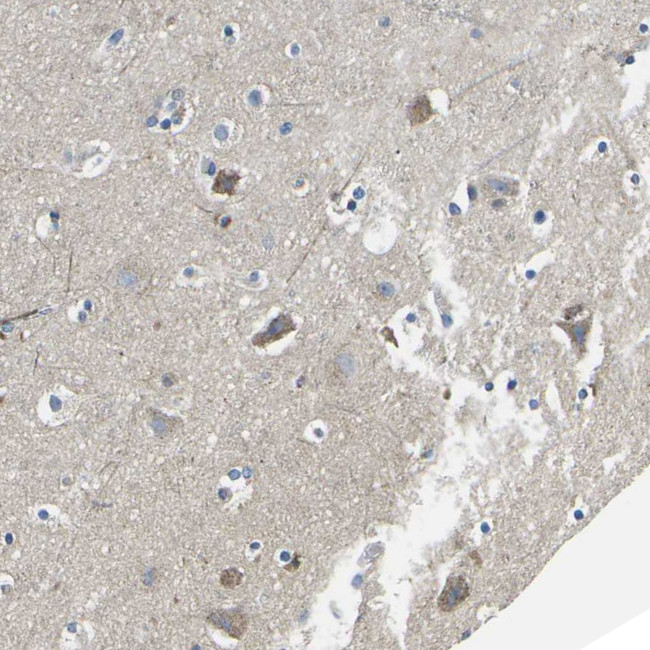TMEFF2 Antibody in Immunohistochemistry (Paraffin) (IHC (P))