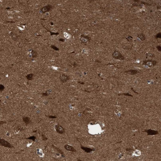 ITFG1 Antibody in Immunohistochemistry (IHC)