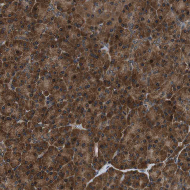 TBC1D15 Antibody in Immunohistochemistry (Paraffin) (IHC (P))