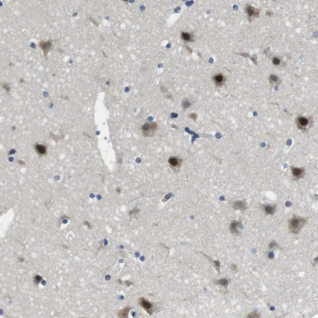 LRRC49 Antibody in Immunohistochemistry (Paraffin) (IHC (P))