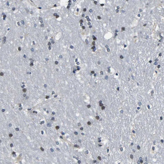 SNX10 Antibody in Immunohistochemistry (IHC)