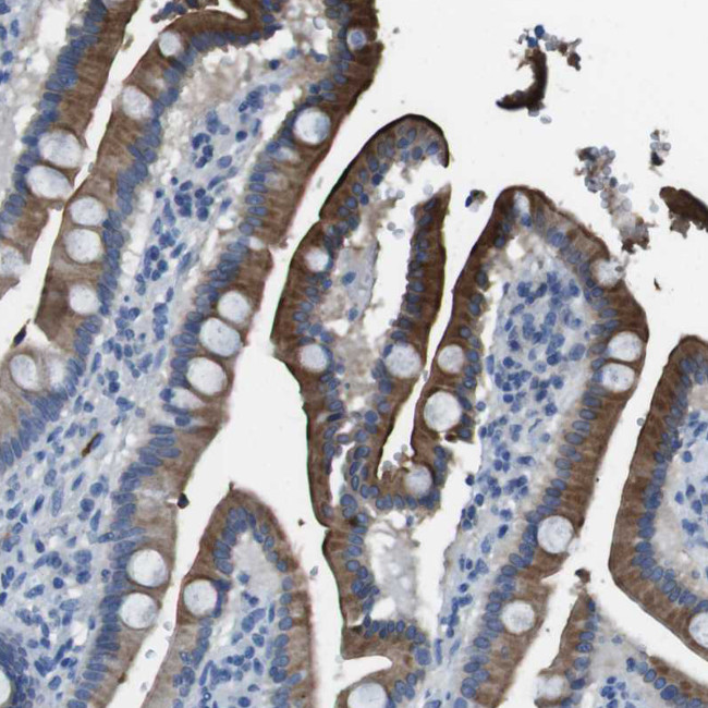 TMPRSS15 Antibody in Immunohistochemistry (IHC)