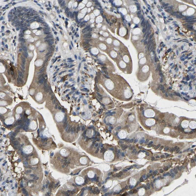 SCNN1B Antibody in Immunohistochemistry (Paraffin) (IHC (P))