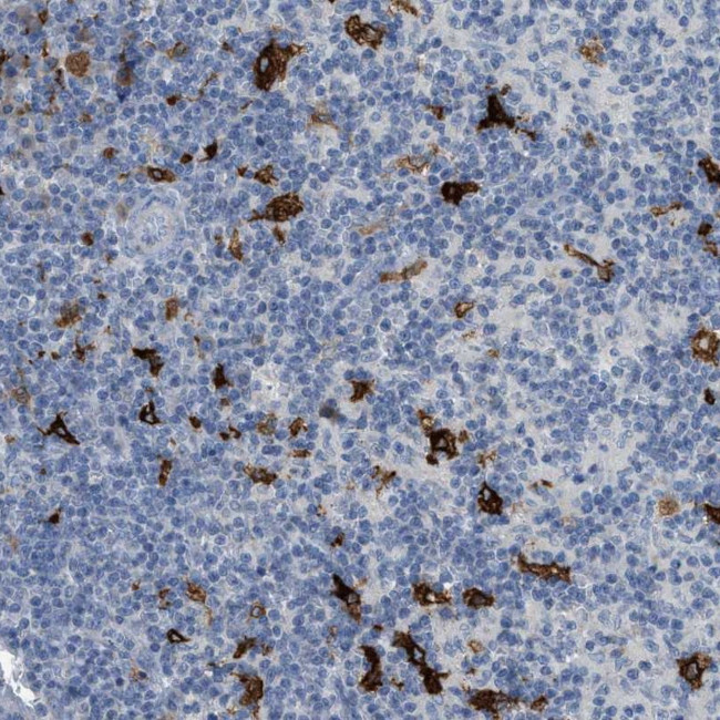 TIMD4 Antibody in Immunohistochemistry (Paraffin) (IHC (P))