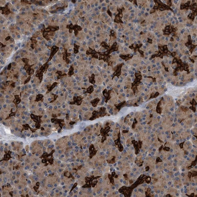 BAP3 Antibody in Immunohistochemistry (Paraffin) (IHC (P))