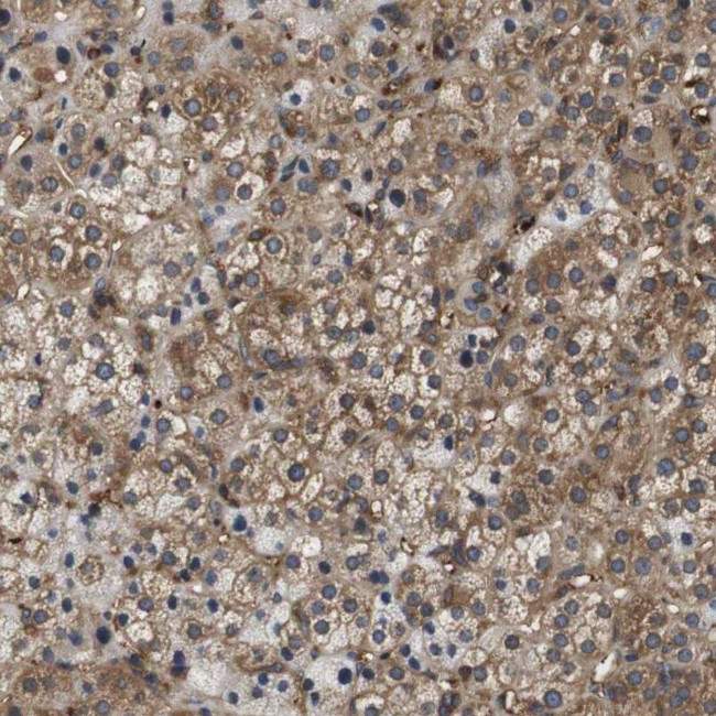 HERPUD2 Antibody in Immunohistochemistry (IHC)