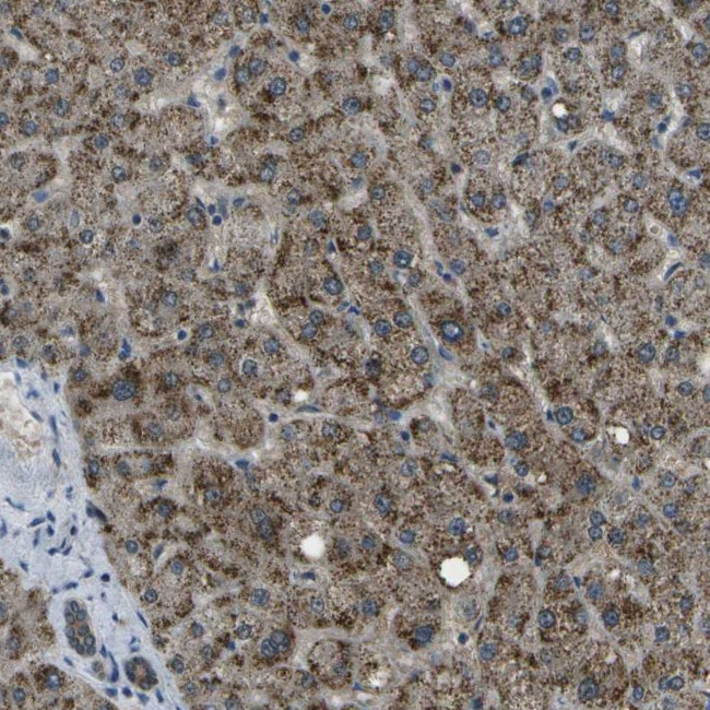 APOBEC4 Antibody in Immunohistochemistry (Paraffin) (IHC (P))