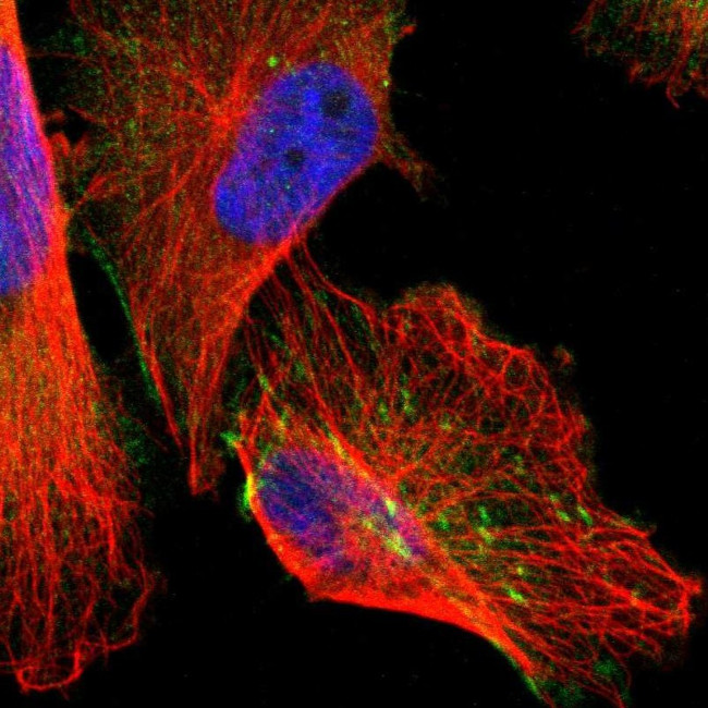 AFAP Antibody in Immunocytochemistry (ICC/IF)