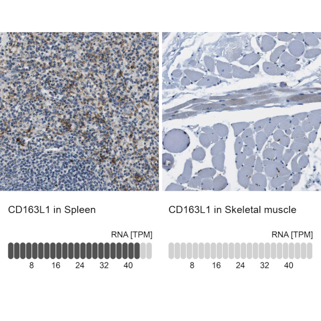 CD163L1 Antibody in Immunohistochemistry (IHC)