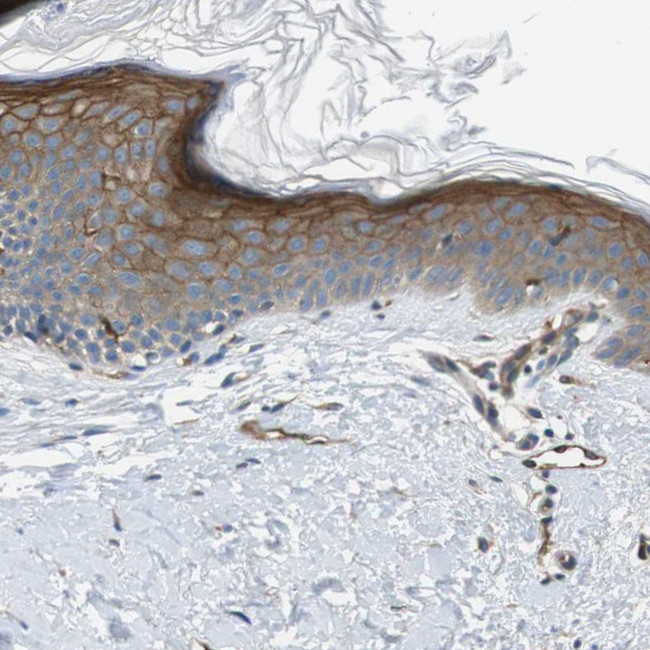 PALD1 Antibody in Immunohistochemistry (IHC)