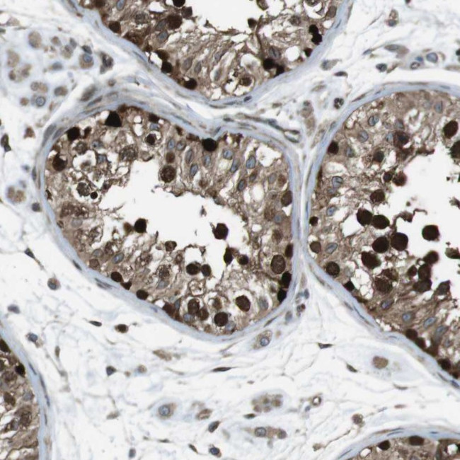 ZNF330 Antibody in Immunohistochemistry (Paraffin) (IHC (P))