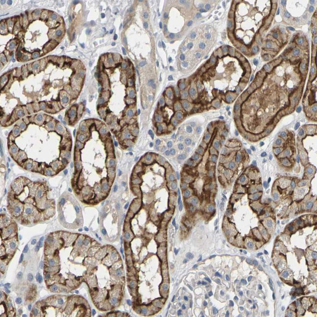C21orf63 Antibody in Immunohistochemistry (Paraffin) (IHC (P))