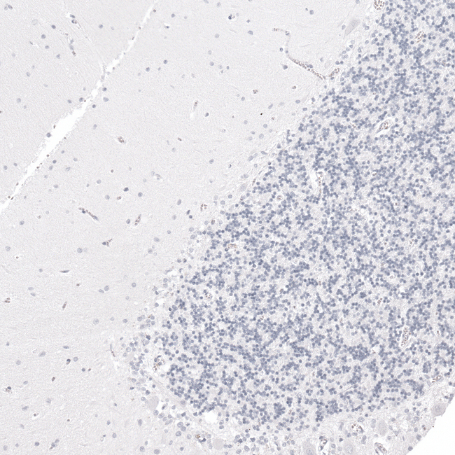 GP2 Antibody in Immunohistochemistry (Paraffin) (IHC (P))