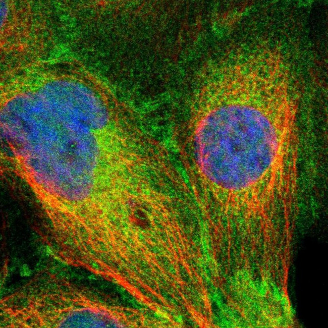 SLK Antibody in Immunocytochemistry (ICC/IF)