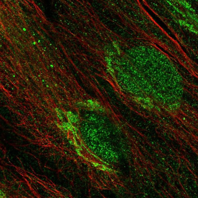 PFTK2 Antibody in Immunocytochemistry (ICC/IF)