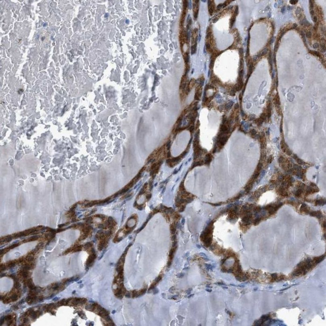 RBBP9 Antibody in Immunohistochemistry (IHC)