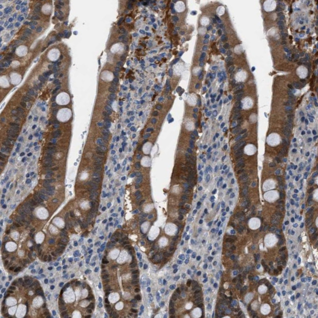 TMEM45B Antibody in Immunohistochemistry (Paraffin) (IHC (P))