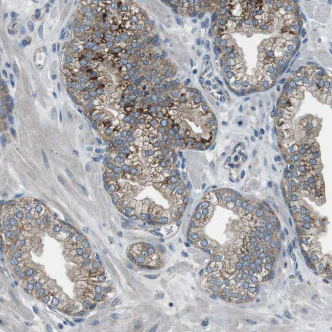 FAM3B Antibody in Immunohistochemistry (IHC)