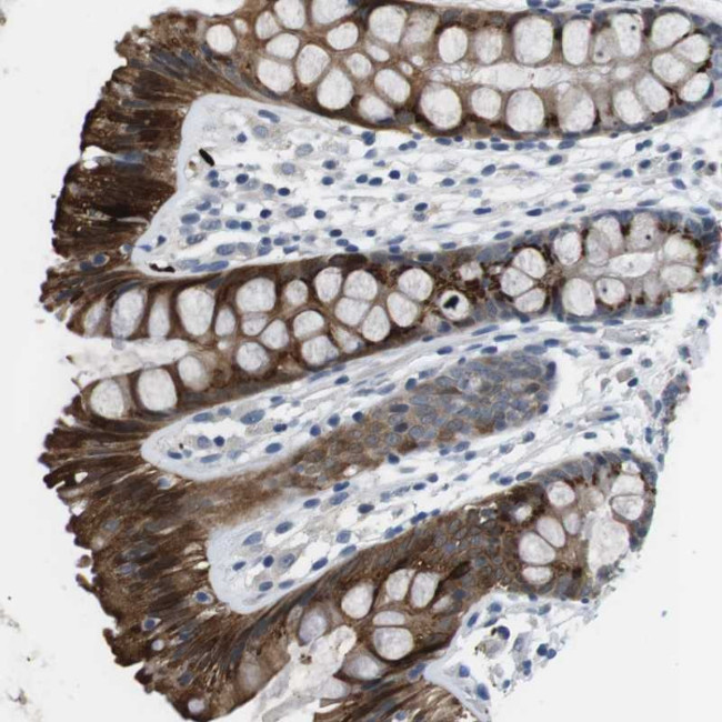 WSCD1 Antibody in Immunohistochemistry (Paraffin) (IHC (P))