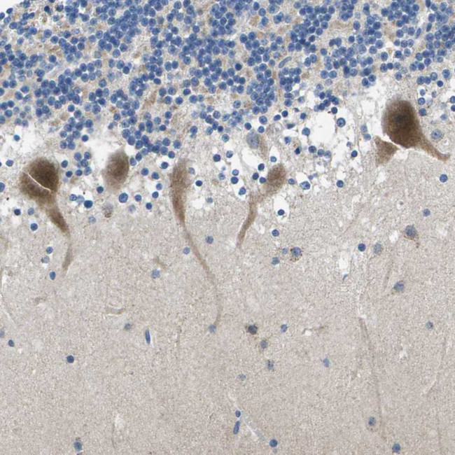 ERGIC3 Antibody in Immunohistochemistry (Paraffin) (IHC (P))