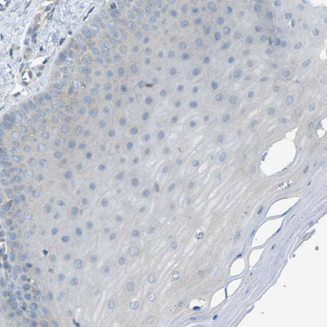 PIEZO2 Antibody in Immunohistochemistry (Paraffin) (IHC (P))