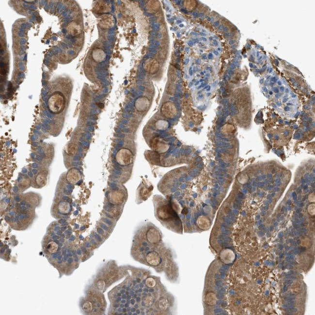 PIGG Antibody in Immunohistochemistry (Paraffin) (IHC (P))