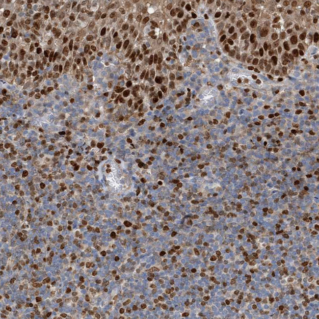 SH3D19 Antibody in Immunohistochemistry (Paraffin) (IHC (P))