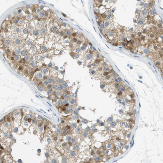 Cullin 9 Antibody in Immunohistochemistry (Paraffin) (IHC (P))