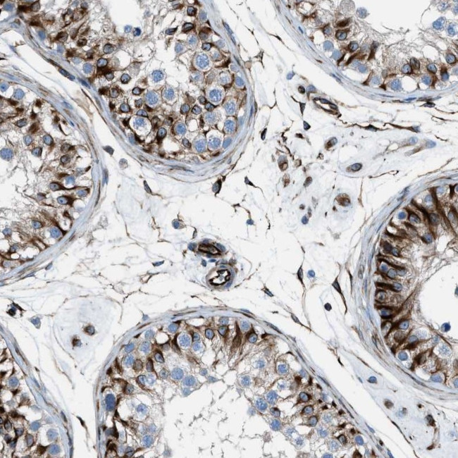 CABP7 Antibody in Immunohistochemistry (Paraffin) (IHC (P))